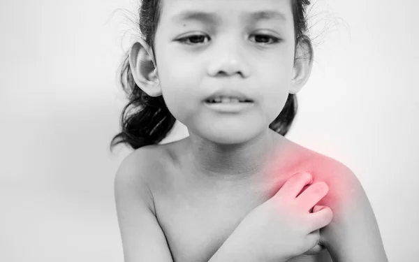 Young girl scratch the itch with hand ,neck, itching. red effect.