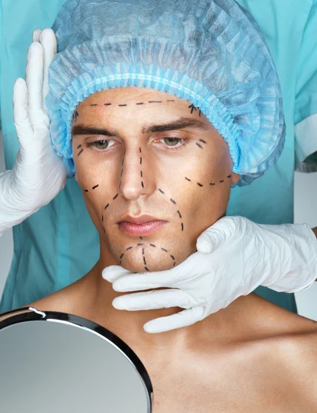 Beautiful Man with perforation lines on his face before plastic surgery operation
