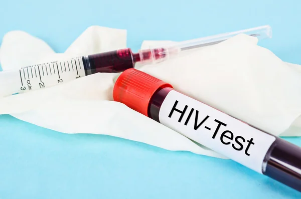 Sample blood for screening test for HIV test.