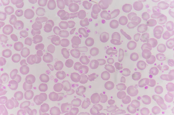Red blood cells with white blood cells background.