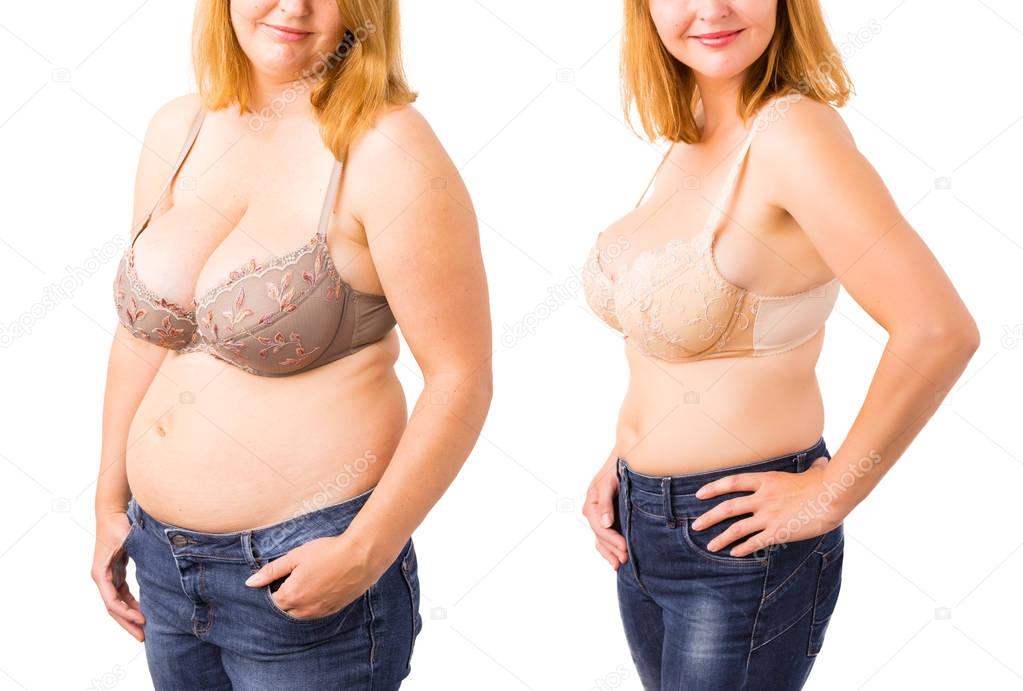Резкая Потеря Веса У Женщин