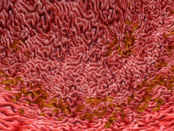 Inside the intestines