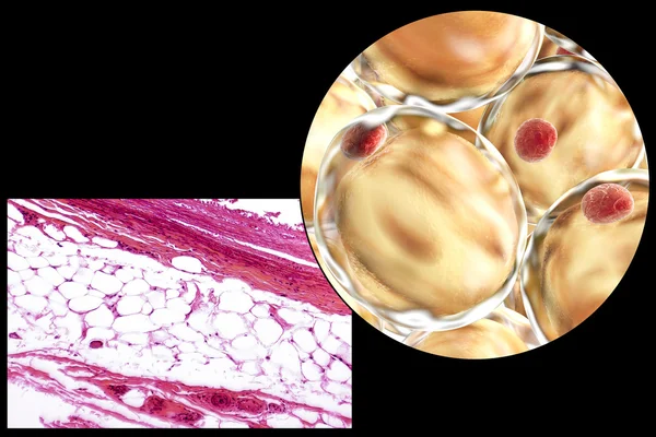 Fat cells, micrograph and 3D illustration