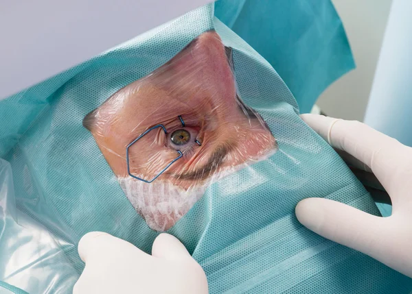 Eye check-up exam