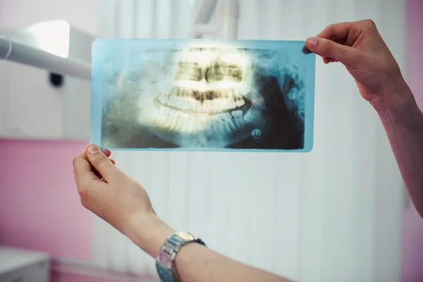 Doctor holding x-ray of human jaws
