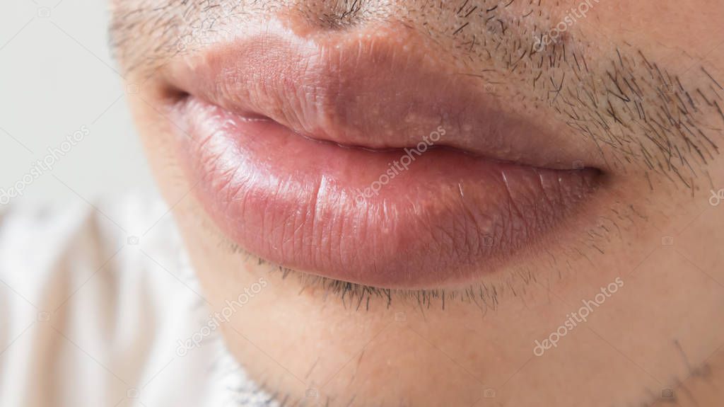 What are some common health problems concerning the lips?