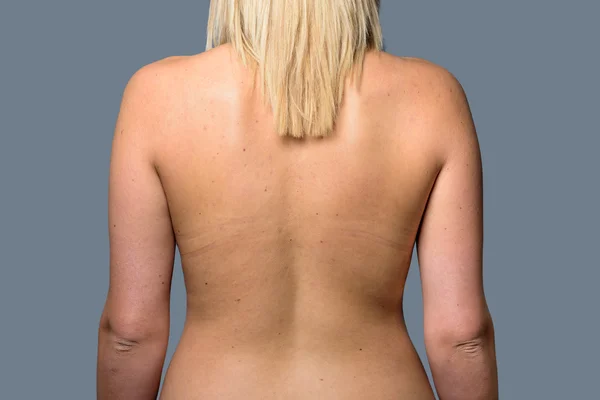 The Back of a Young Blonde Woman