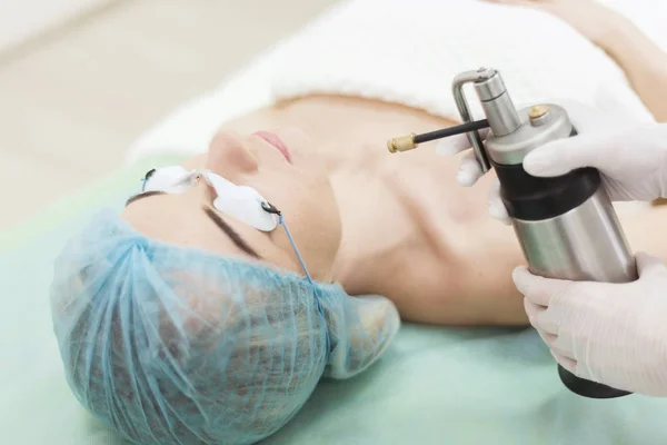 Liquid nitrogen cryotherapy procedure — Stock Photo, Image