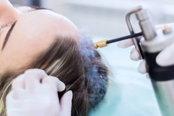 Liquid nitrogen cryotherapy procedure — Stock Photo, Image