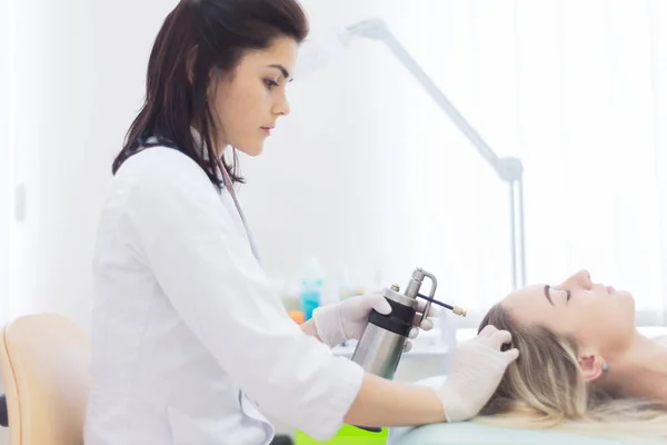 Liquid nitrogen cryotherapy procedure — Stock Photo, Image