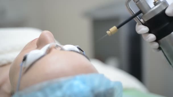 Medische cryotherapie pistool. vloeibare stikstof. Arts maakt de patiënt cryotherapie procedure - Cryomassage - koude behandeling. cosmetologie kliniek — Stockvideo