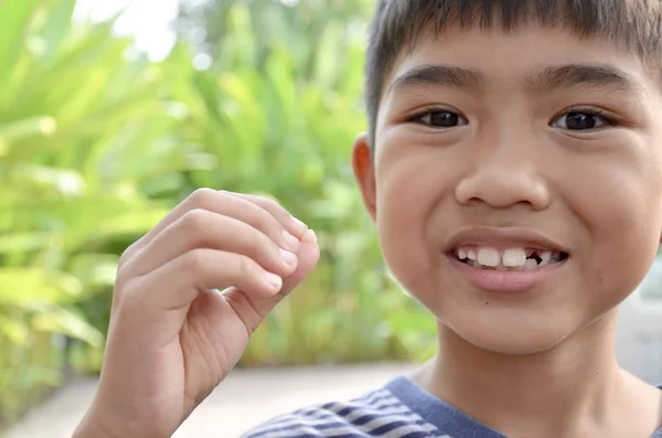 Yaşlı Asya çocuk onun kırık diş gösterir bir yedi yıl seçici odak diş parmağında