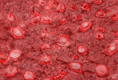 Virüs hücresi Çin patojen solunum gribi Coronavirus Covid-19 mikroskop altında.