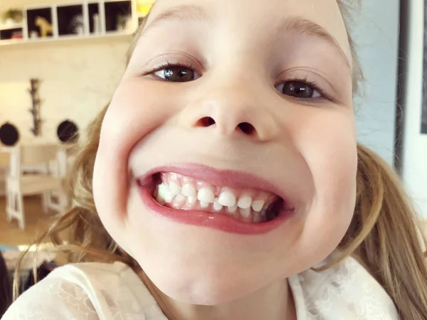 Lustiges Gesicht eines kleinen Mädchens mit weißen Zähnen — Stockfoto