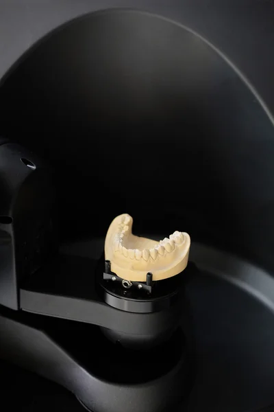 Set van valse tanden verwerkt in de speciaal apparaat voor tandartsen — Stockfoto