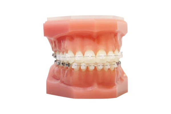 Bir takma diş görüntüsünü — Stok fotoğraf