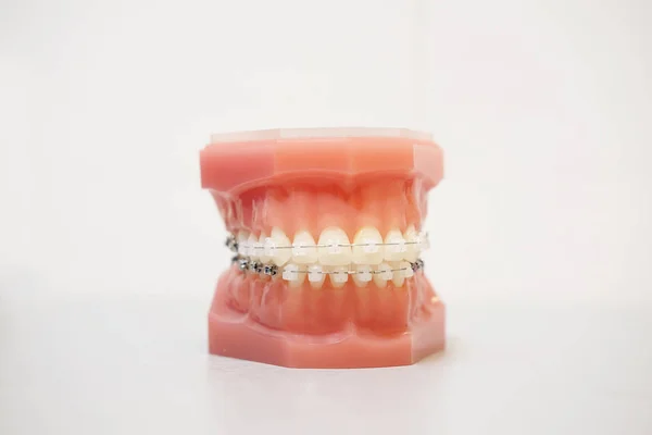 Image of a denture — Stock Photo, Image