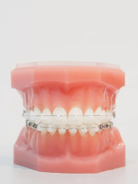 Image of a denture close up — Stock Photo, Image