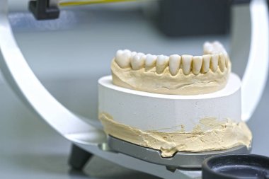 takma diş görüntüsünü kapat