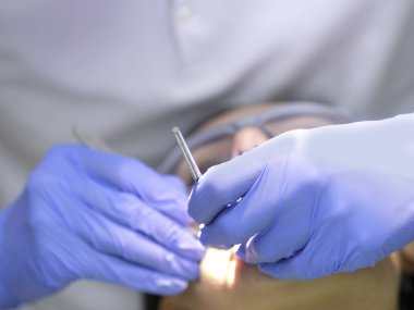 Dantist'ın el yakın çekim