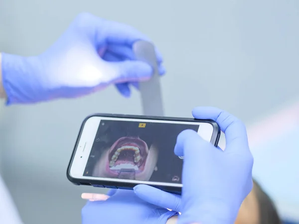 Dentista Filma Bocca Del Paziente Con Smartphone — Foto Stock