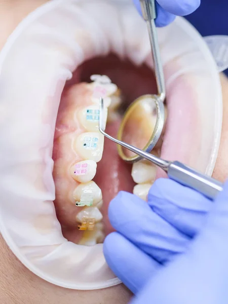 Ağız Olan Dişçi Hastanın Yakın Çekim — Stok fotoğraf