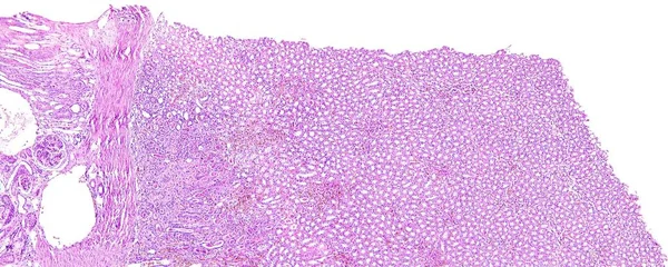 인간의 신장 근 위 관 상피 흐린 붓기 — 스톡 사진