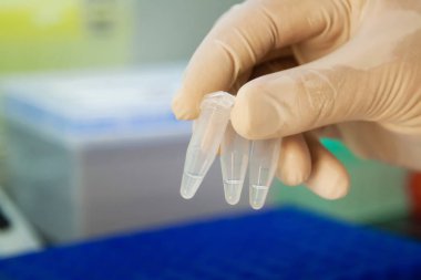 Üç test tüpleri gösterilen el 