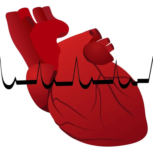 Het menselijk hart en cardiogram myocardiaal infarct. Vectorbeelden