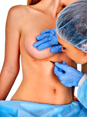 Doktor noktalı çizgi üzerinde kadın meme yapıyor. .