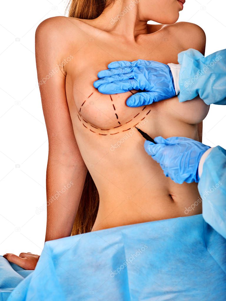 Plastic surgery doctor drawing line woman patient breast augmentation implant