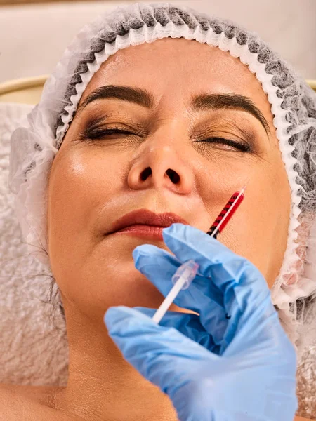 Dermale vullers lippen van vrouw in spa salon met schoonheidsspecialiste. — Stockfoto