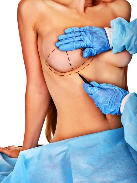 Ο γιατρός κάνει διάστικτη γραμμή στο γυναικείο στήθος . — Φωτογραφία Αρχείου