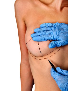 Doktor noktalı çizgi üzerinde kadın meme yapıyor..