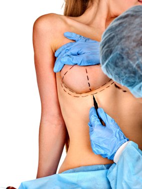 Plastik cerrahi doktor çizim satırı kadın hastanın göğüs büyütme implant