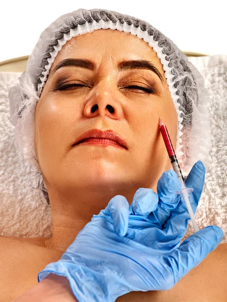 Cara femenina de inyección de relleno. Cirugía facial plástica en clínica de belleza . — Foto de Stock