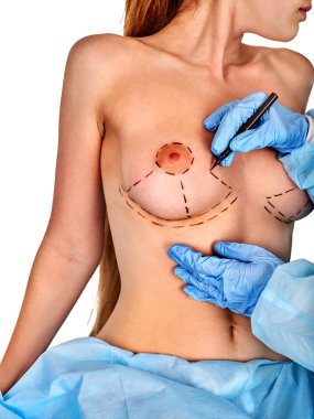 Plastik cerrahi doktor çizim satırı kadın hastanın göğüs büyütme implant