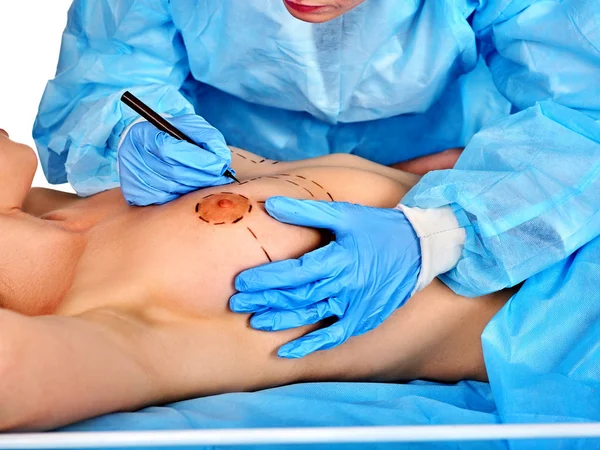 Doctor makes dotted line on female breast .