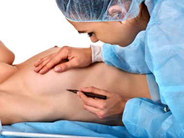 Kadın çıplak vücut parçası. Meme implantları ve plastik cerrahi.