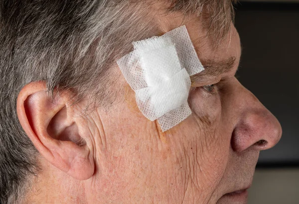 Visão lateral do homem sênior após cirurgia MOHS para remover o câncer de pele com curativos — Fotografia de Stock