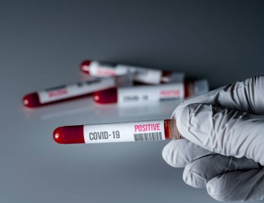 Gloved hand holding a test tube of blood with positive results to Coronavirus check