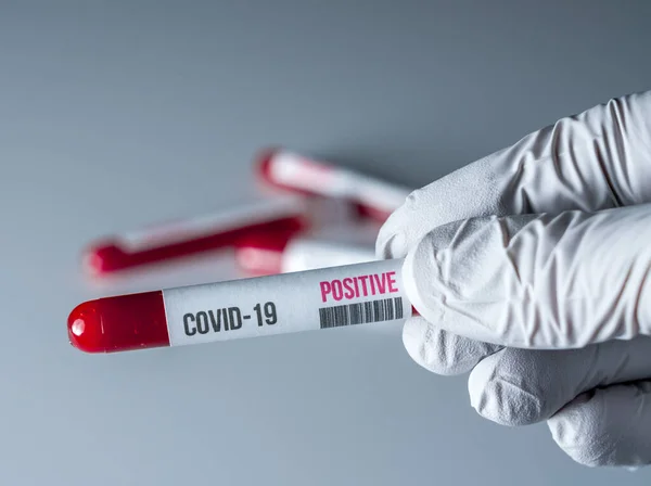 Рука в перчатках держит пробирку крови с положительными результатами для коронавируса — стоковое фото