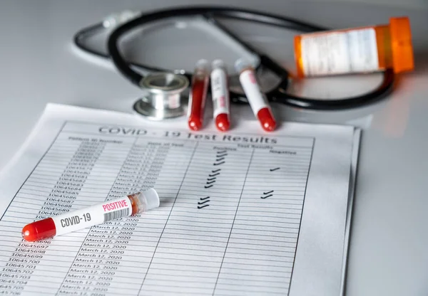 Test tube of blood with positive results to Coronavirus check — ストック写真