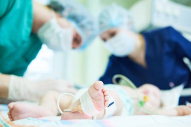 Neonatal resüsitasyon. Doktorlar ekibi yoğun terapi için yeni doğan bebek yapıyor