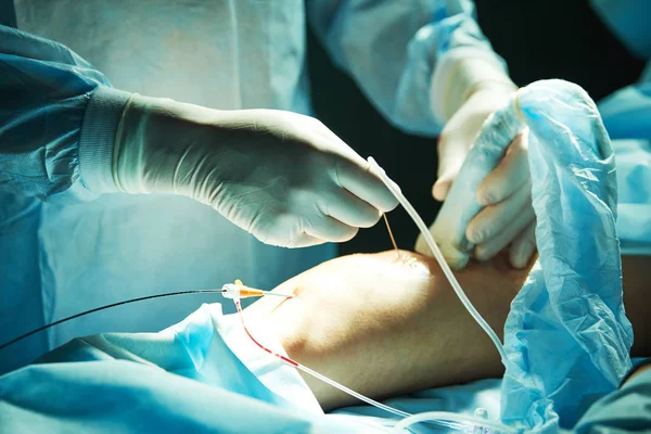 Хірургічне втручання вени — стокове фото