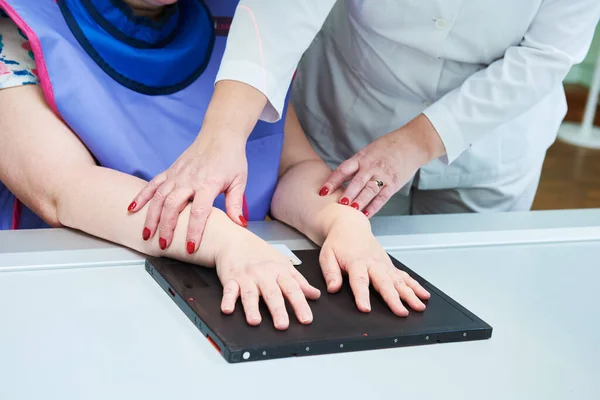 Diagnóza rentgenu fraktur rukou — Stock fotografie