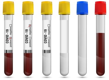 Beyaz arka planda kapaklı ve etiketli şeffaf cam test tüpleri