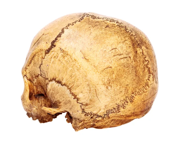 Gamla mänsklig skalle — Stockfoto