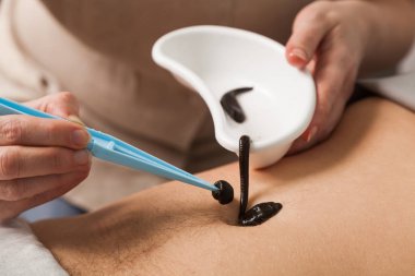 Doktor bir sülük koyar