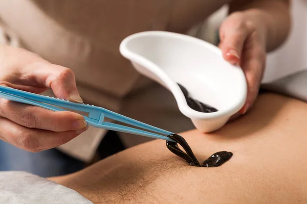 The doctor puts a leech — Stock Photo, Image